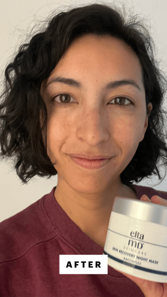 Pai after applying EltaMD Skin Recovery Night Mask