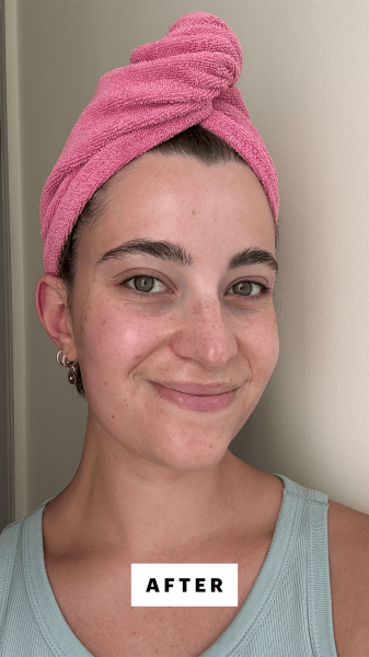 Felbin after applying the Glow Recipe Watermelon Glow AHA Night Treatment